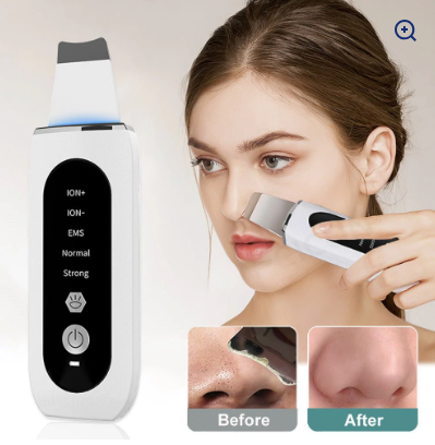 Shovel Skin Blackhead Ultrasonic Beauty Microcurrent Color Light